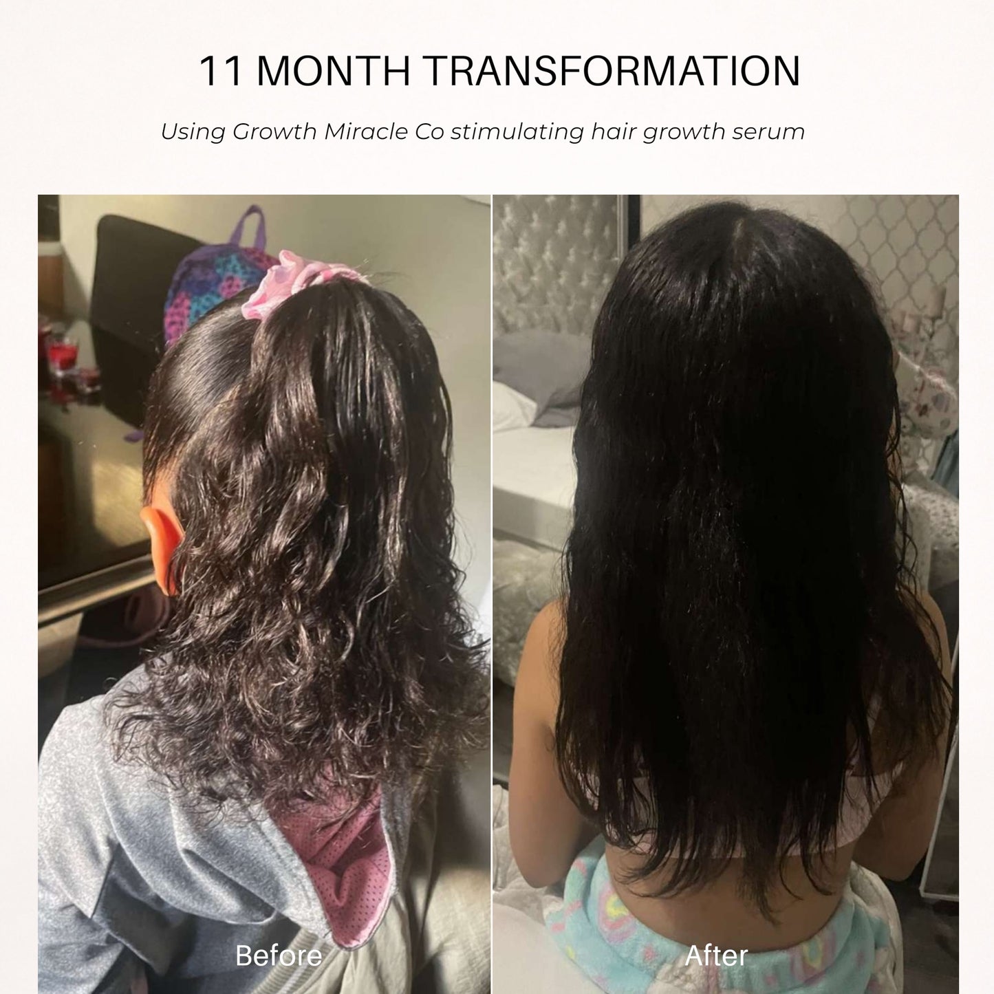 Stimulating Hair Growth Serum